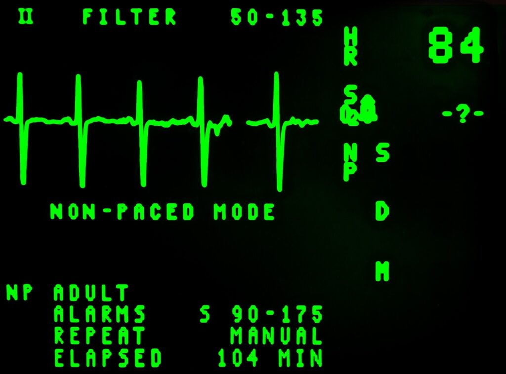 electrocardiogram, beat, cardiology-16948.jpg